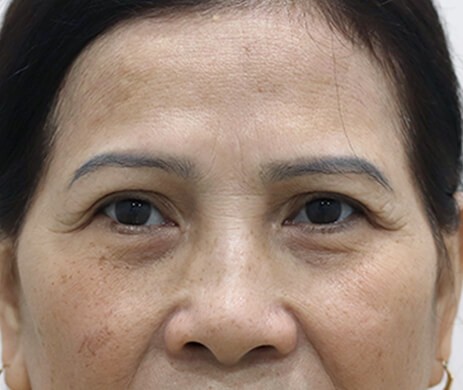 treo cung mày