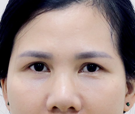 treo cung mày