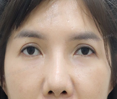 TREO CUNG MÀY