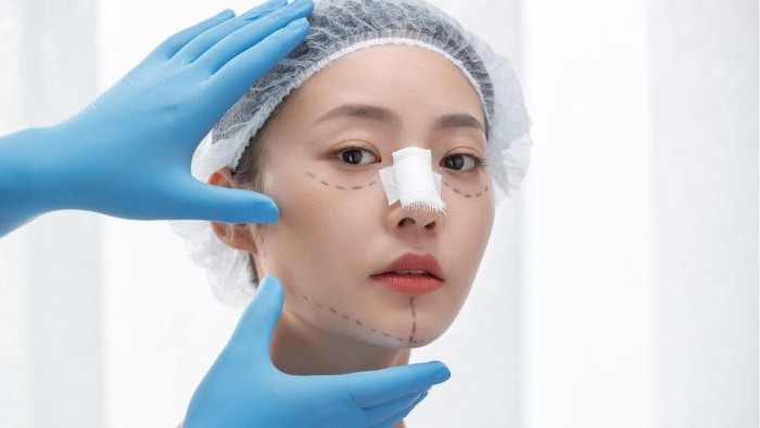 Nâng Mũi Cấu Trúc Hàn Quốc