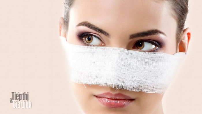 5 câu hỏi cần đặt ra trước khi nâng mũi