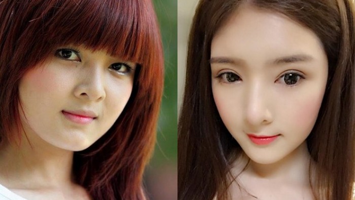 Lilly Luta trước & sau phẫu thuật thẩm mỹ