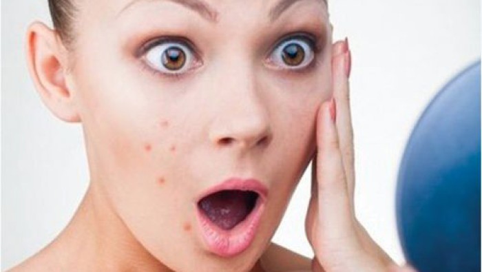 Dị ứng mỹ phẩm và những điều cần lưu ý
