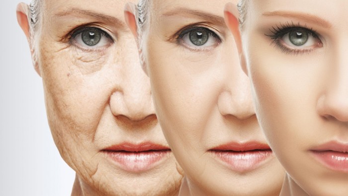 Ưu – Khuyết điểm khi tiêm Botox