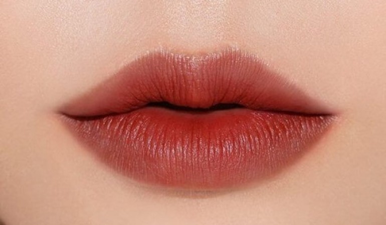 Các phương pháp thẩm mỹ môi tại Charming