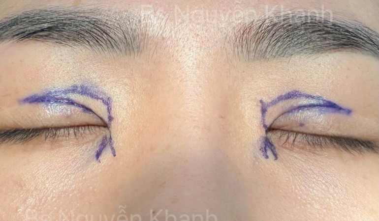 Hành trình mở góc mắt của bạn khách tại TMV Charming