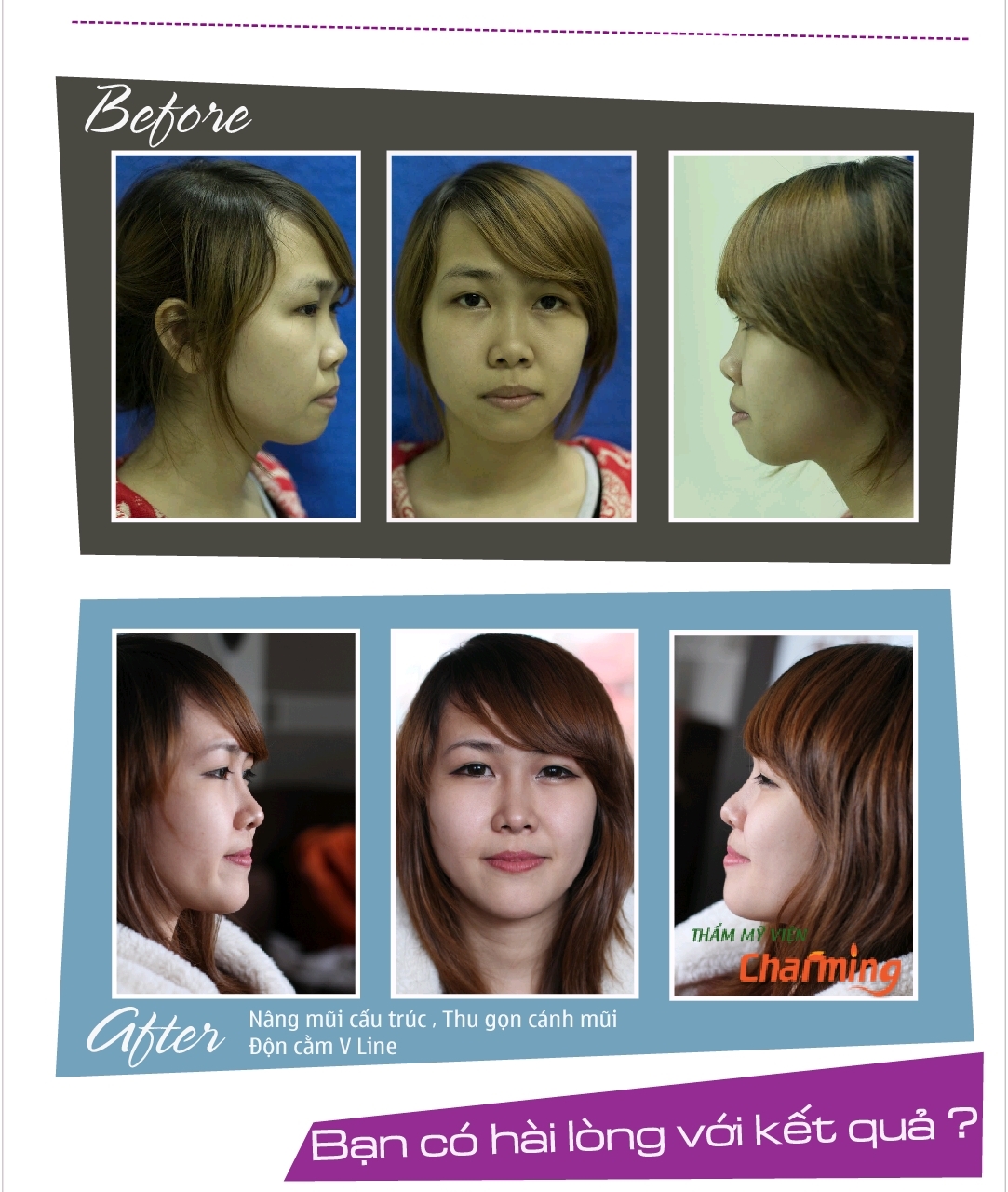 Thúy Hoa