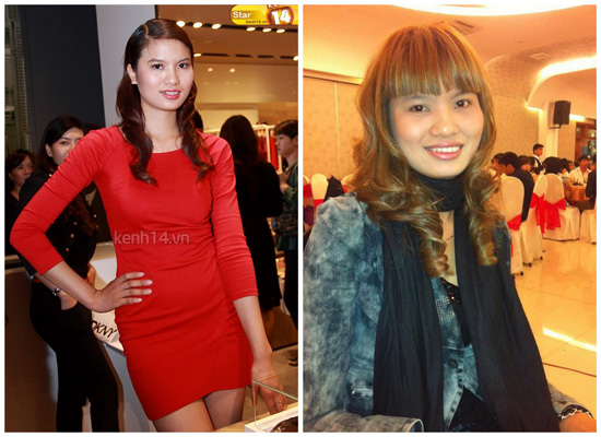 sửa mũi