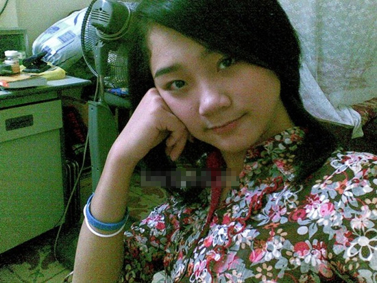 sửa mũi