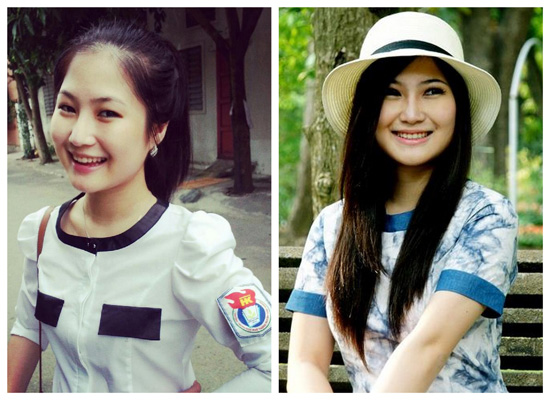 sửa mũi