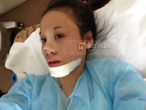 Bà Tưng phẫu thuật thẩm mỹ