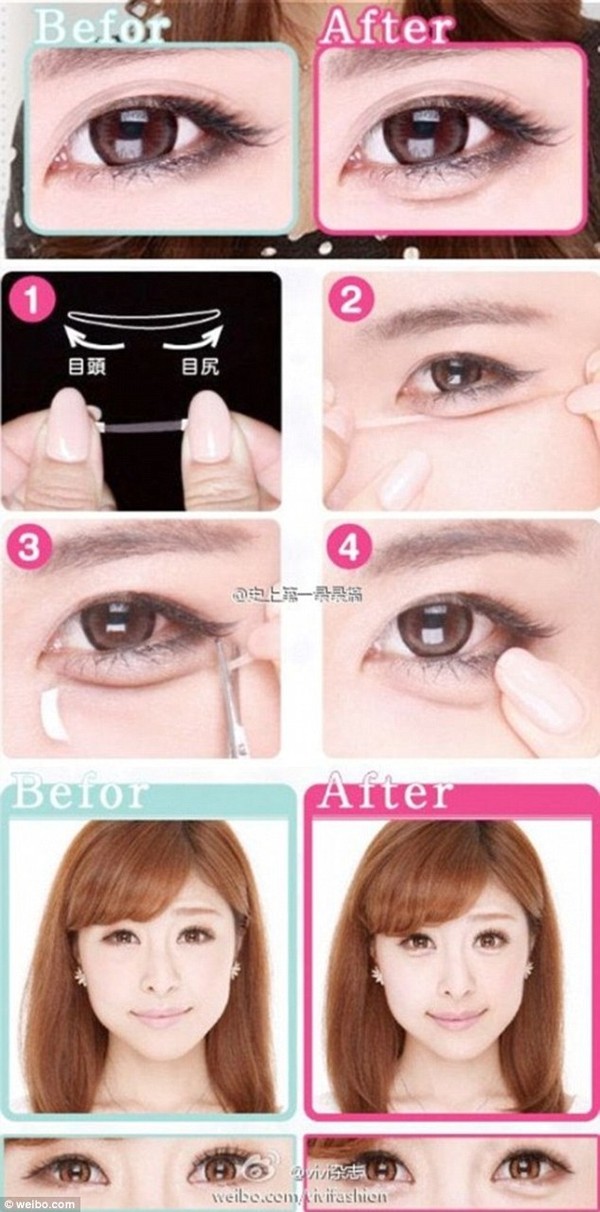 bọng mắt lớn Hàn Quốc