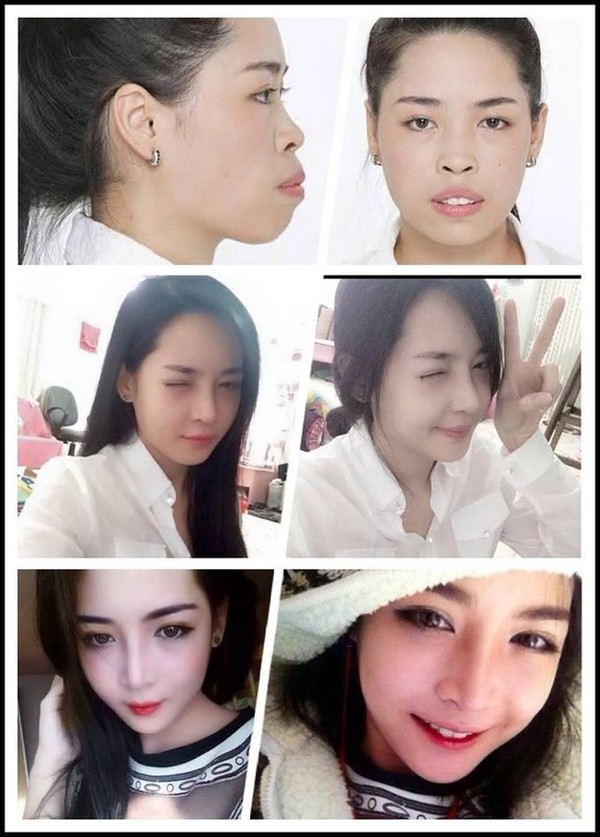 phẫu thuật thẩm mỹ