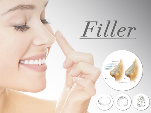 Filler
