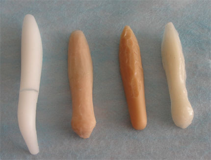 nâng mũi