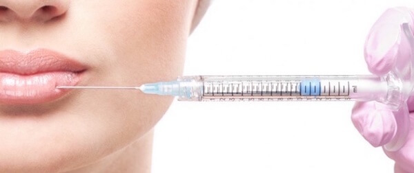 tiêm filler