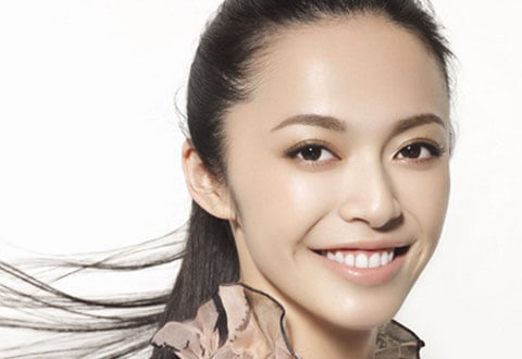 cười hở lợi